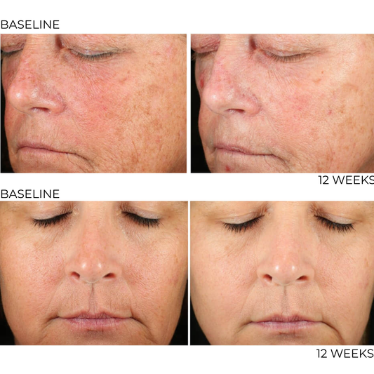 Retinol Rx 0.5% All Trans-Retinol