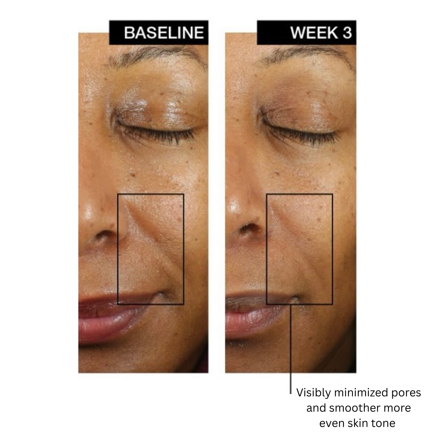 Lactic Acid Retexturizing Serum