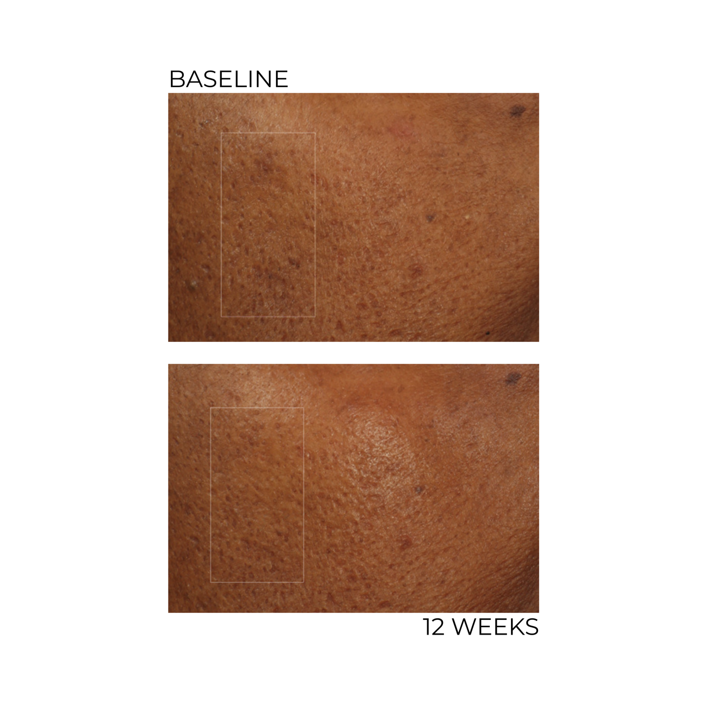 Advanced Cellular Repair Complex
