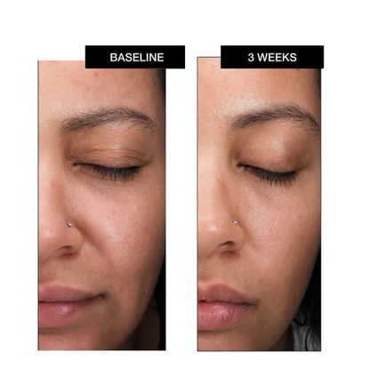Lactic Acid Retexturizing Serum