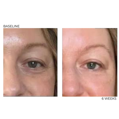 Peptide Firming Eye Cream