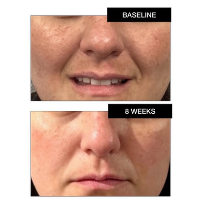 Pigment Correcting Serum 15% Niacinamide