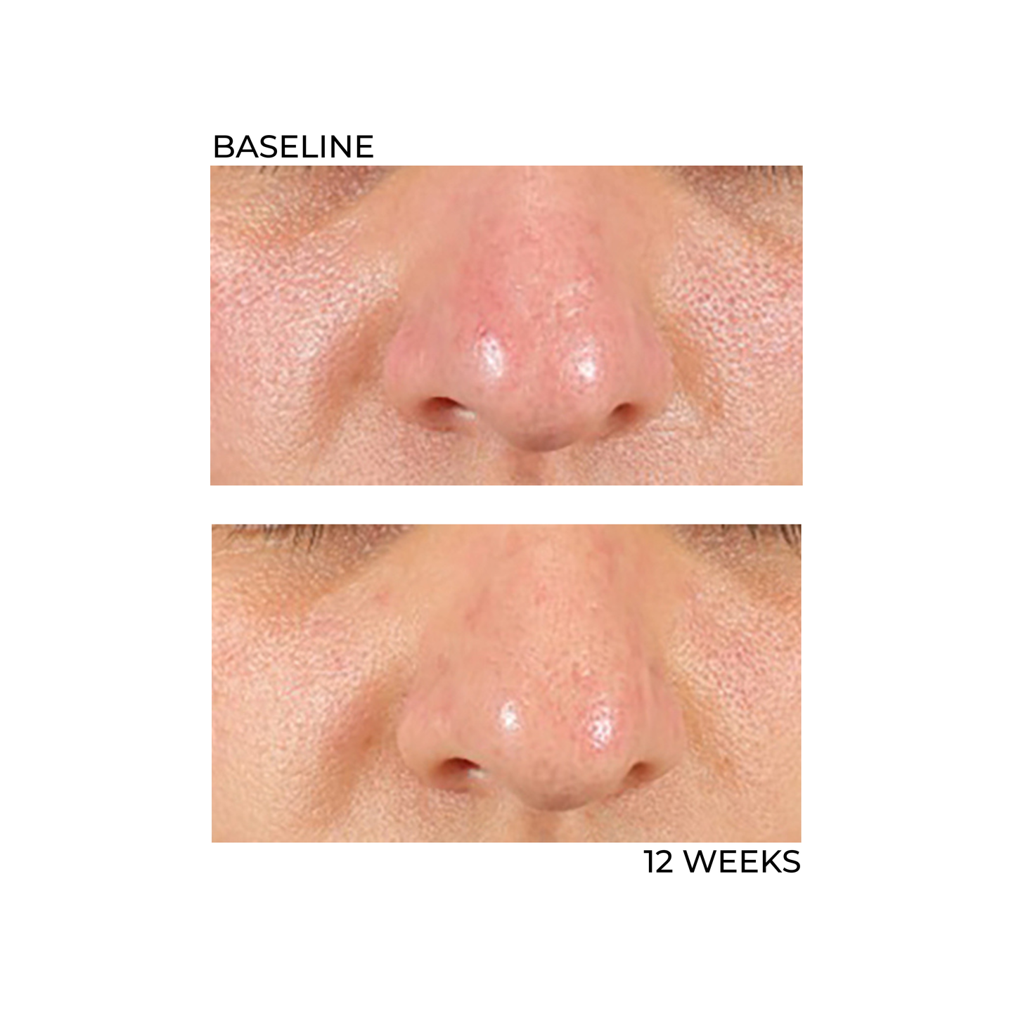 Advanced Cellular Repair Complex