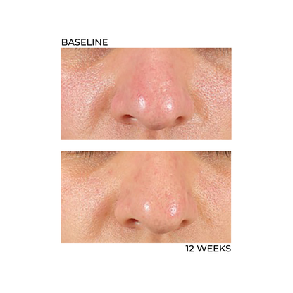 Advanced Cellular Repair Complex