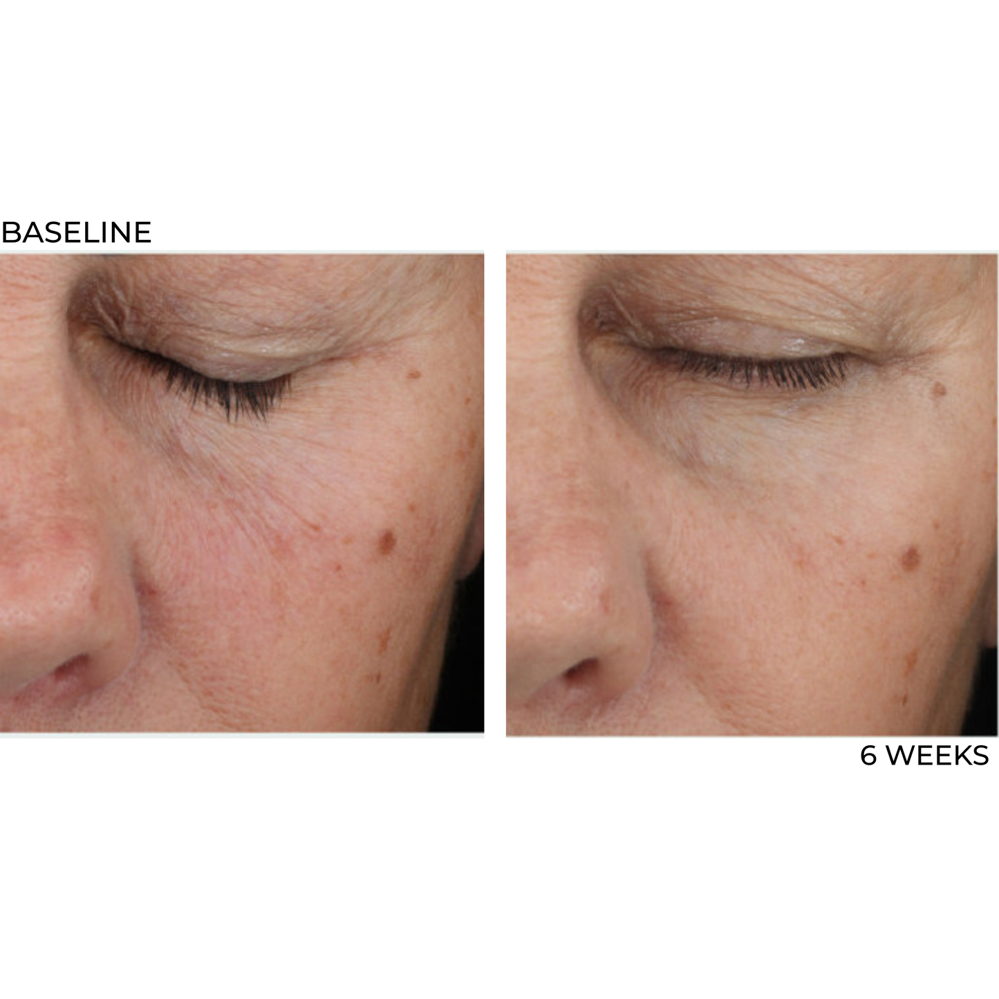Retinol Rx 0.5% All Trans-Retinol