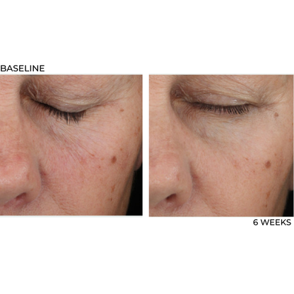 Retinol Rx 0.5% All Trans-Retinol