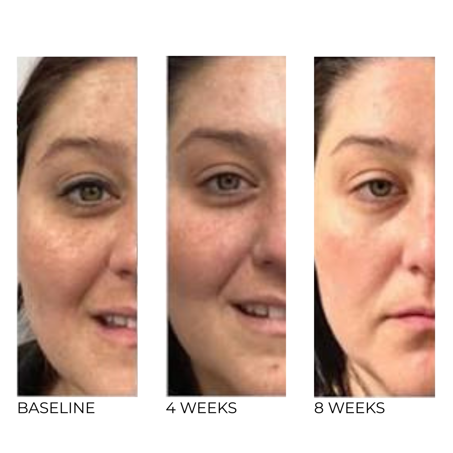 Pigment Correcting Serum 15% Niacinamide